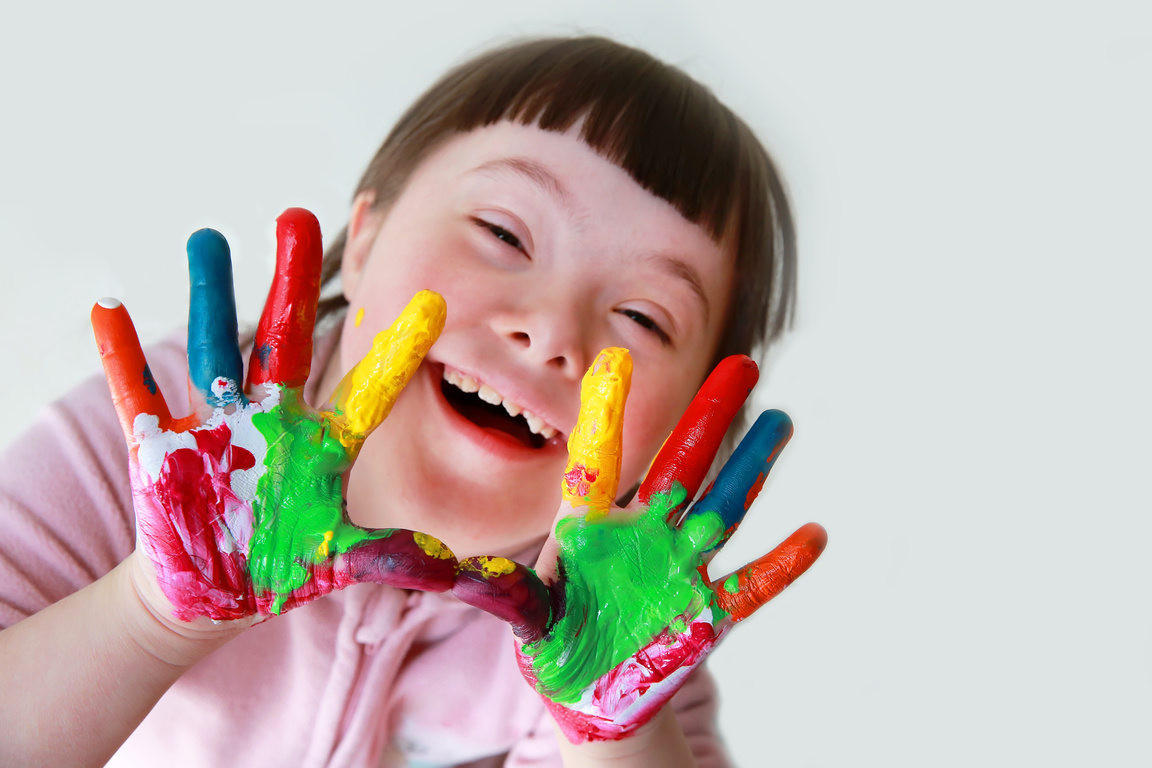 Cute Little down Syndrome Girl with Painted Hands